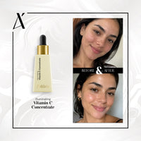 Illuminating Vitamin C Concentrate