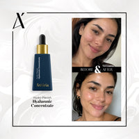 Hydro-Plenish Hyaluronic Concentrate