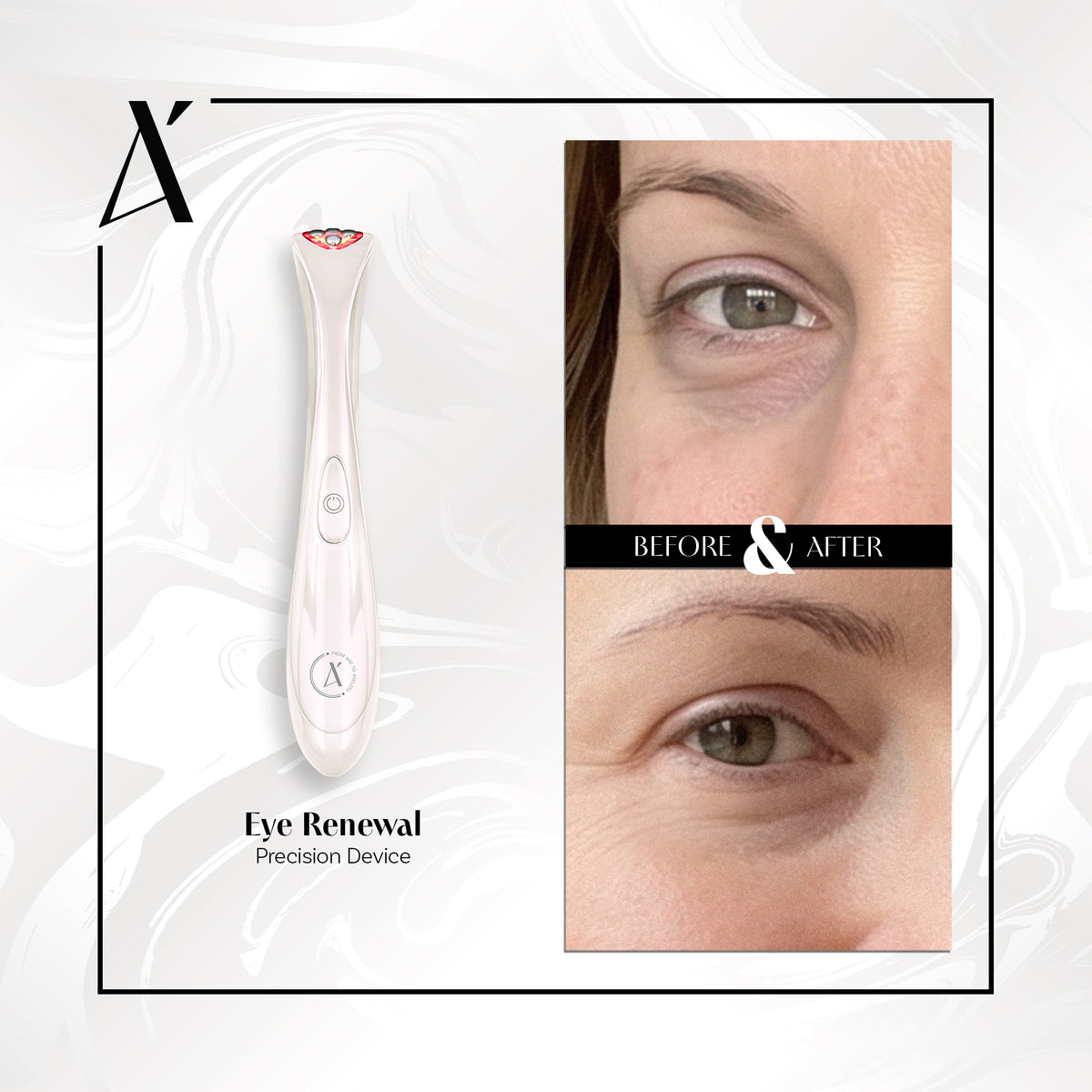 Eye Renewal Precision Device