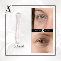 Eye Renewal Precision Device