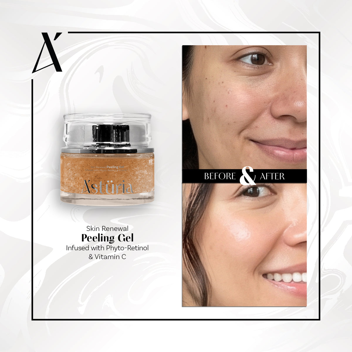 Skin Renewal Peeling Gel Infused with Phyto-Retinol & Vitamin C