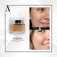 Skin Renewal Peeling Gel Infused with Phyto-Retinol & Vitamin C